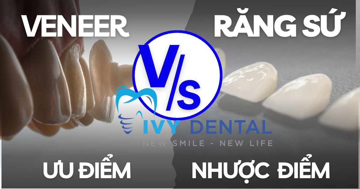 nha khoa ivy - Ưu điểm  Nhược điểm của hai phương pháp thẩm mỹ phổ biến hiện nay Răng Sứ và Mặt Dán Sứ