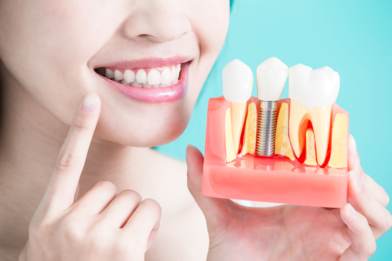implant