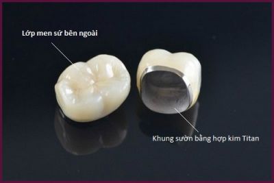 Có Nên Trồng Răng Sứ Không? Những Vấn Đề Không Thể Bỏ Lỡ