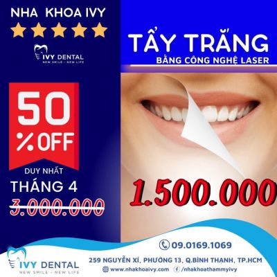 Chương trình ưu đãi tháng 04.2023 - Giảm giá 50% tẩy trắng răng
