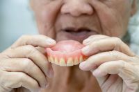 Ưu và nhược điểm của phục hình Răng Tháo Lắp