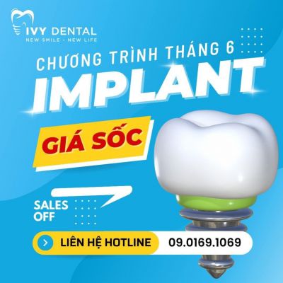 Chương trình ưu đãi tháng 06.2023 - Implant giá sốc