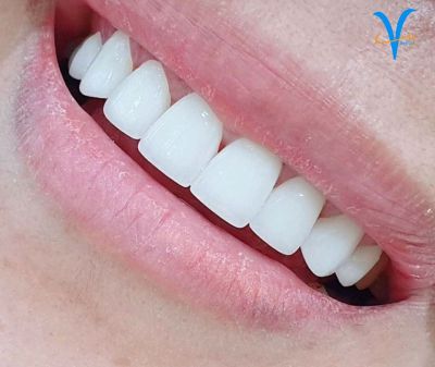 Nha Khoa IVY - Nơi Niềng Răng Uy Tín TPHCM